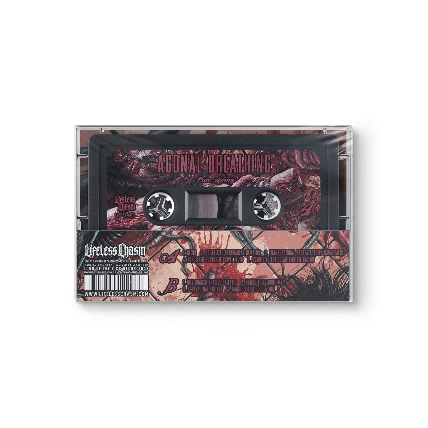 Agonal Breathing "Pure Agony" CASSETTE