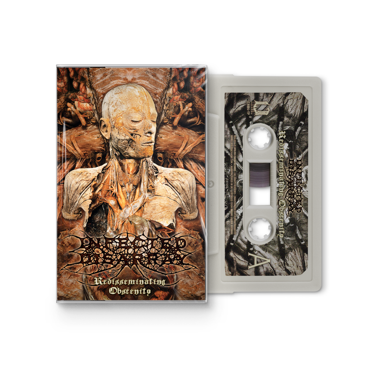 PREORDER | Infected Disarray "Redisseminating Obscenity" CASSETTE
