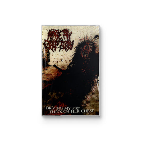 Artery Eruption "Driving My Fist Through Her Chest" CASSETTE