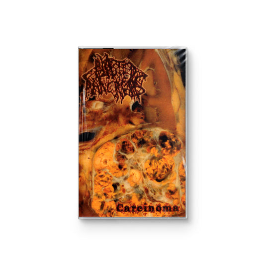 Blasted Pancreas "Carcinoma" CASSETTE