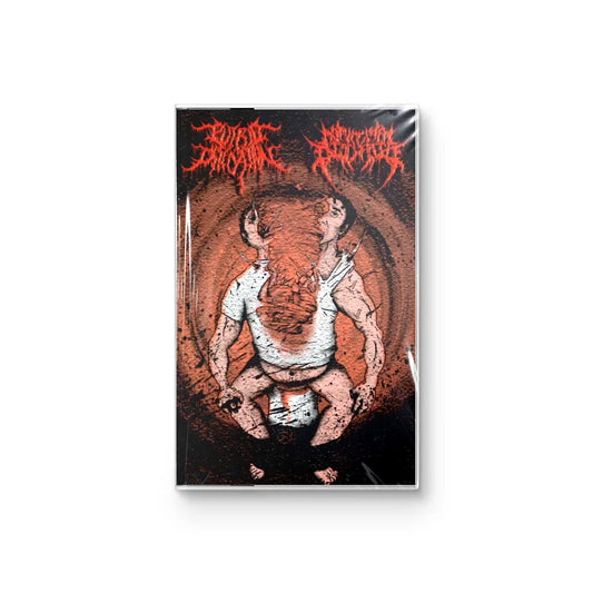Monumental Discharge & Putrid Defecation "Monumental Putridity" CASSETTE