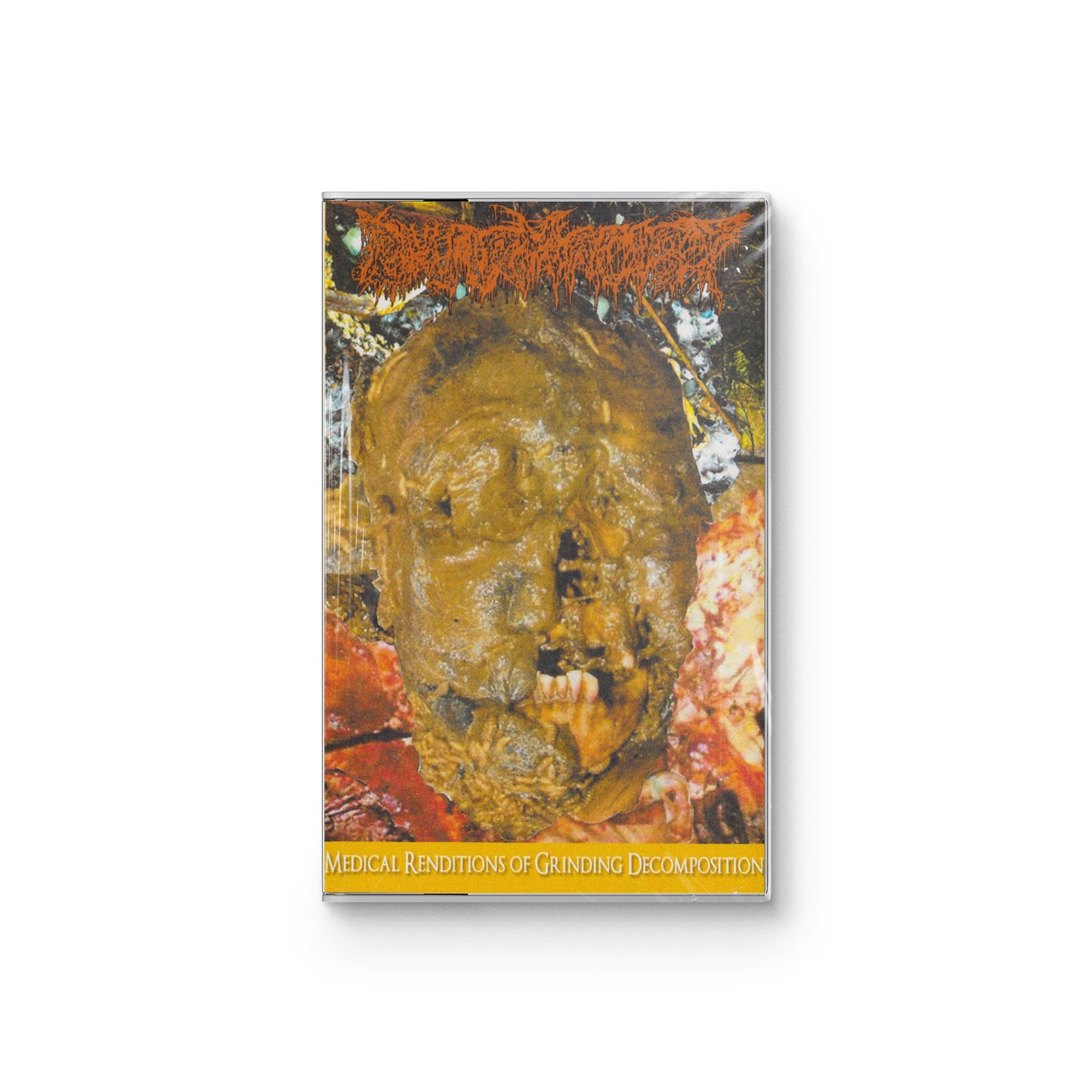 Pharmacist "Medical Renditions Of Grinding Decomposition" CASSETTE