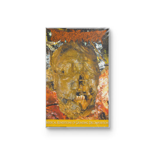Pharmacist "Medical Renditions Of Grinding Decomposition" CASSETTE