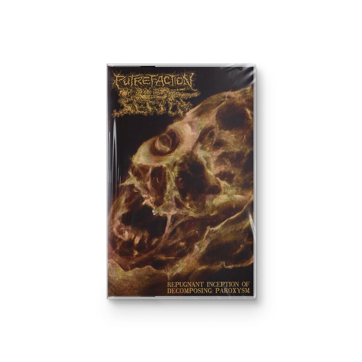 Putrefaction Sets In "Repugnant Inception Of Decomposing Paroxysm" CASSETTE